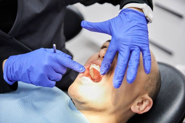 Best Emergency Wisdom Tooth Extraction in Jesup, IA